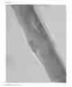 Fig. 03 - Hatching fluid enzymes and uses thereof
