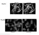 Fig. 12 - Mutant NGAL proteins and uses thereof