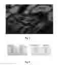 Fig. 15 - Mutant NGAL proteins and uses thereof