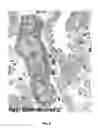 Fig. 16 - Mutant NGAL proteins and uses thereof