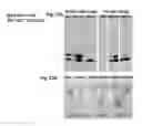 Fig. 29 - Mutant NGAL proteins and uses thereof