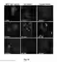 Fig. 34 - Mutant NGAL proteins and uses thereof