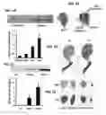 Fig. 02 - MODULATION OF ESTROGEN RECEPTOR-RELATED RECEPTOR GAMMA (ERR GAMMA) AND USES THEREFOR