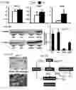Fig. 10 - MODULATION OF ESTROGEN RECEPTOR-RELATED RECEPTOR GAMMA (ERR GAMMA) AND USES THEREFOR