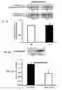 Fig. 11 - MODULATION OF ESTROGEN RECEPTOR-RELATED RECEPTOR GAMMA (ERR GAMMA) AND USES THEREFOR
