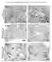 Fig. 38 - Therapeutic uses of modified FGF-21 polypeptides