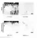 Fig. 57 - Therapeutic uses of modified FGF-21 polypeptides