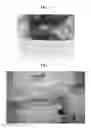 Fig. 02 - CODON-OPTIMIZED RECOMBINANT PLASMID, METHOD OF STIMULATING PERIPHERAL NERVE REGENERATION, AND METHOD OF TREATING NERVE DAMAGE IN HUMANS