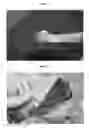Fig. 04 - CODON-OPTIMIZED RECOMBINANT PLASMID, METHOD OF STIMULATING PERIPHERAL NERVE REGENERATION, AND METHOD OF TREATING NERVE DAMAGE IN HUMANS