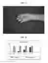Fig. 08 - CODON-OPTIMIZED RECOMBINANT PLASMID, METHOD OF STIMULATING PERIPHERAL NERVE REGENERATION, AND METHOD OF TREATING NERVE DAMAGE IN HUMANS