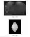 Fig. 12 - METHODS OF TREATING COGNITIVE IMPAIRMENT