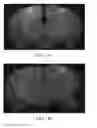 Fig. 15 - METHODS OF TREATING COGNITIVE IMPAIRMENT