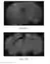 Fig. 16 - METHODS OF TREATING COGNITIVE IMPAIRMENT