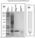 Fig. 04 - Mitrecin a polypeptide with antimicrobial activity