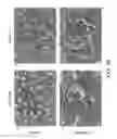 Fig. 33 - Methods for inhibiting fibrosis in a subject in need thereof