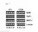 Fig. 08 - Suppression of myeloid derived suppressor cells and immune checkpoint blockade