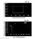 Fig. 07 - PHOSPHOLIPID DEPOT