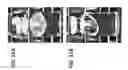 Fig. 12 - Formulations with reduced degradation of polysorbate