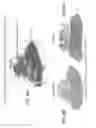 Fig. 07 - Angiotensinogen (AGT) iRNA compositions and methods of use thereof