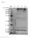Fig. 03 - METHOD OF PREPARING FLUORESCENT SILK PROTEIN SOLUTION EXTRACTED FROM TRANSGENIC SILKWORM COCOONS AND METHOD OF MANUFACTURING SUPPORT USING THE SAME