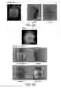Fig. 08 - Contrast agents for magnetic resonance imaging