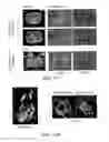 Fig. 09 - Contrast agents for magnetic resonance imaging