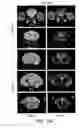 Fig. 11 - Contrast agents for magnetic resonance imaging