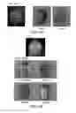 Fig. 08 - Ascorbate formulations and methods of use as contrast agents