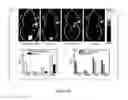 Fig. 19 - Cage-like bifunctional chelators, copper-64 radiopharmaceuticals and PET imaging using the same