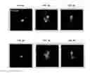 Fig. 04 - Urea-based prostate specific membrane antigen (PSMA) inhibitors for imaging and therapy