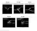 Fig. 06 - Urea-based prostate specific membrane antigen (PSMA) inhibitors for imaging and therapy
