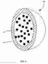 Fig. 05 - BIODEGRADABLE MICROSPHERES INCORPORATING RADIONUCLIDES TECHNICAL FIELD
