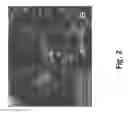 Fig. 05 - Methods for blood-brain barrier disruption using electrical energy