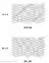 Fig. 06 - BIOABSORBABLE POLYMERIC COMPOSITION FOR A MEDICAL DEVICE