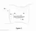 Fig. 02 - WOUND DRAIN AND COVER