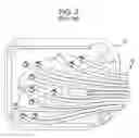 Fig. 04 - Pressure manifold system for dialysis