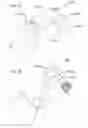 Fig. 13 - Medication infusion device