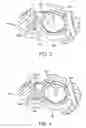 Fig. 04 - Fluid delivery and measurement systems and methods