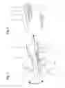 Fig. 05 - Infusion site interfaces and insertion devices for infusion site interfaces