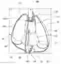Fig. 01 - SYRINGE AND SAFETY CAP ASSEMBLY FOR SYRINGE