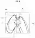 Fig. 10 - SYRINGE AND SAFETY CAP ASSEMBLY FOR SYRINGE