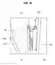 Fig. 17 - SYRINGE AND SAFETY CAP ASSEMBLY FOR SYRINGE