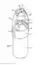 Fig. 01 - Nebulizer and spacer for the topical application of a liquid and/or solid to a surface