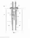 Fig. 02 - Nebulizer and spacer for the topical application of a liquid and/or solid to a surface