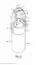 Fig. 03 - Nebulizer and spacer for the topical application of a liquid and/or solid to a surface