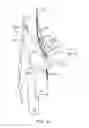 Fig. 02 - SYSTEMS AND METHODS FOR NEUROMODULATION OF SYMPATHETIC AND PARASYMPATHETIC CARDIAC NERVES