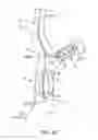 Fig. 03 - SYSTEMS AND METHODS FOR NEUROMODULATION OF SYMPATHETIC AND PARASYMPATHETIC CARDIAC NERVES