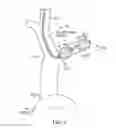 Fig. 06 - SYSTEMS AND METHODS FOR NEUROMODULATION OF SYMPATHETIC AND PARASYMPATHETIC CARDIAC NERVES