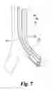 Fig. 06 - Catheters and systems useful for delivery of material to the lung