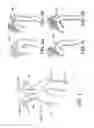 Fig. 02 - Methods and apparatus for an adjustable stiffness catheter